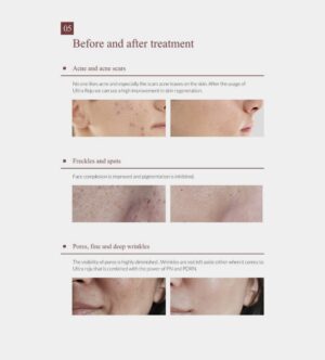Cosmoderma Soonsu Ultra Reju - Image 6