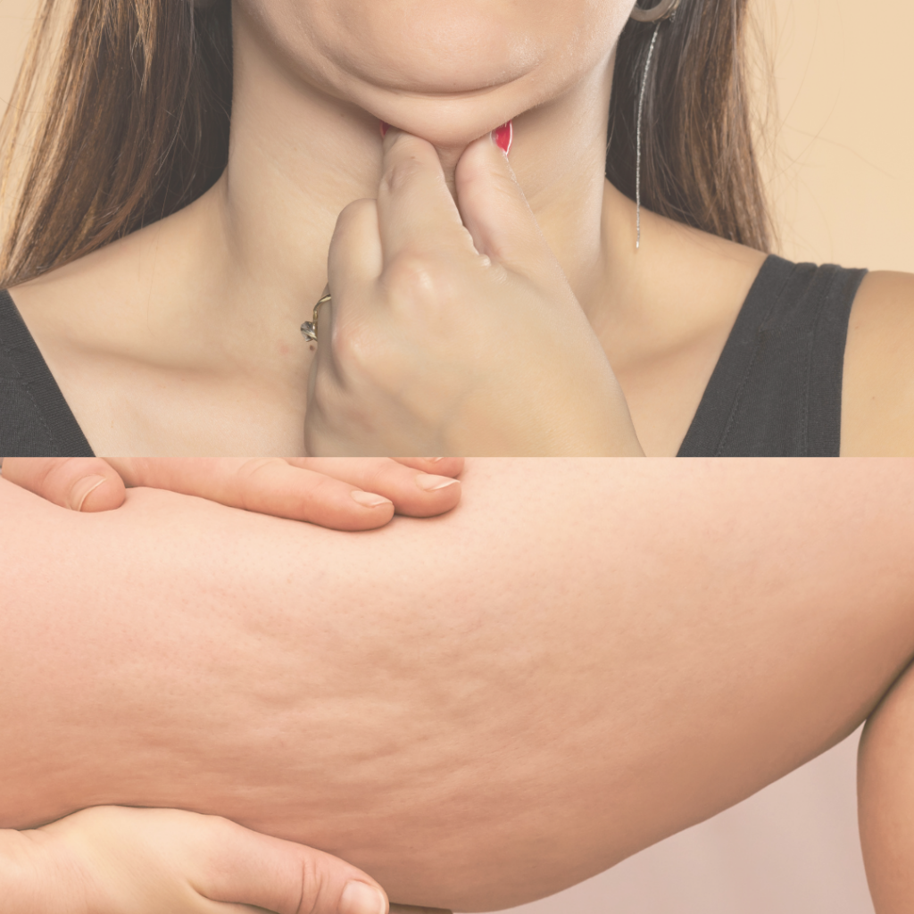 Body care, Fat dissolve, LIPO