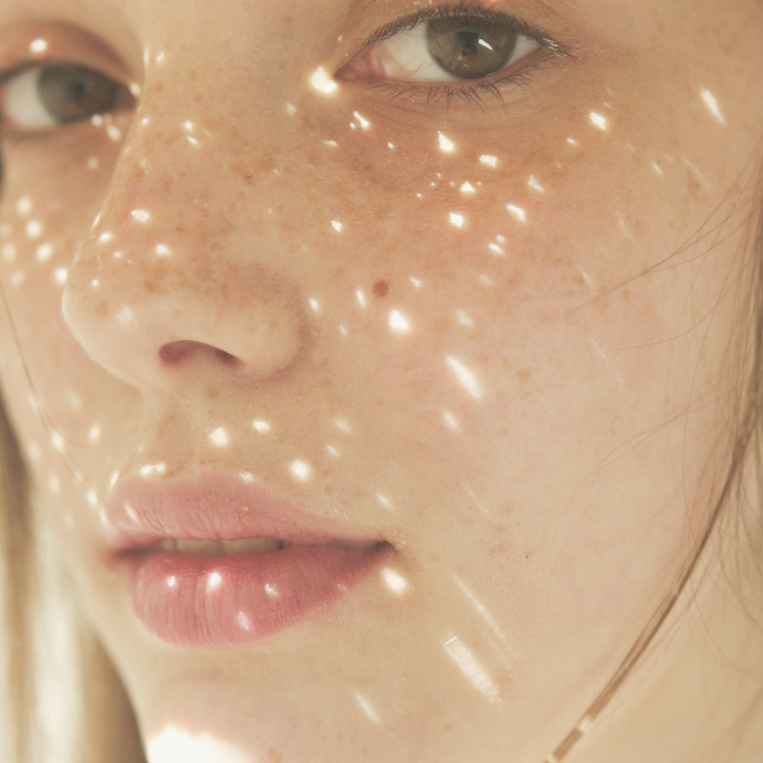 Pigmented skin, melasma care, dark spots, sun spots
