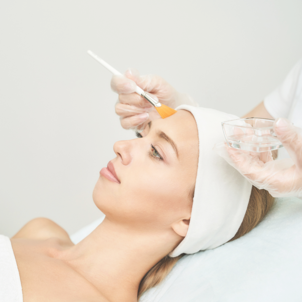 chemical peeling, AHA, BHA, PHA, TCA peels