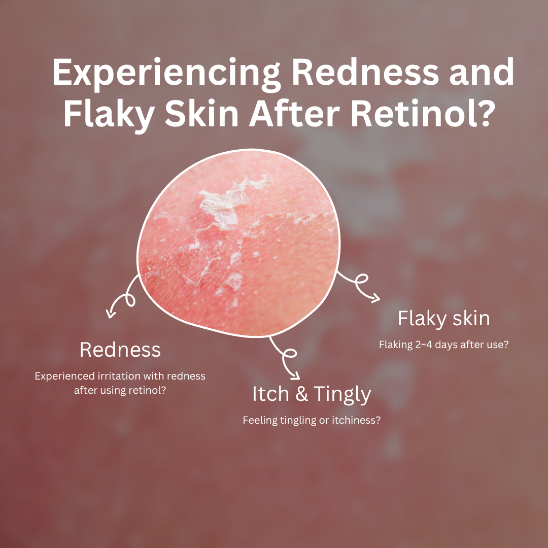 Everything about retinol how to use it without irritatoin