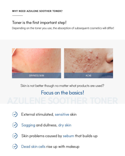 Dr. Sante Azulene Soother Toner (200ml) - Image 4