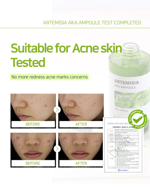 Dr.Sante Artemisia AKA Ampoule (100ml) - Image 7