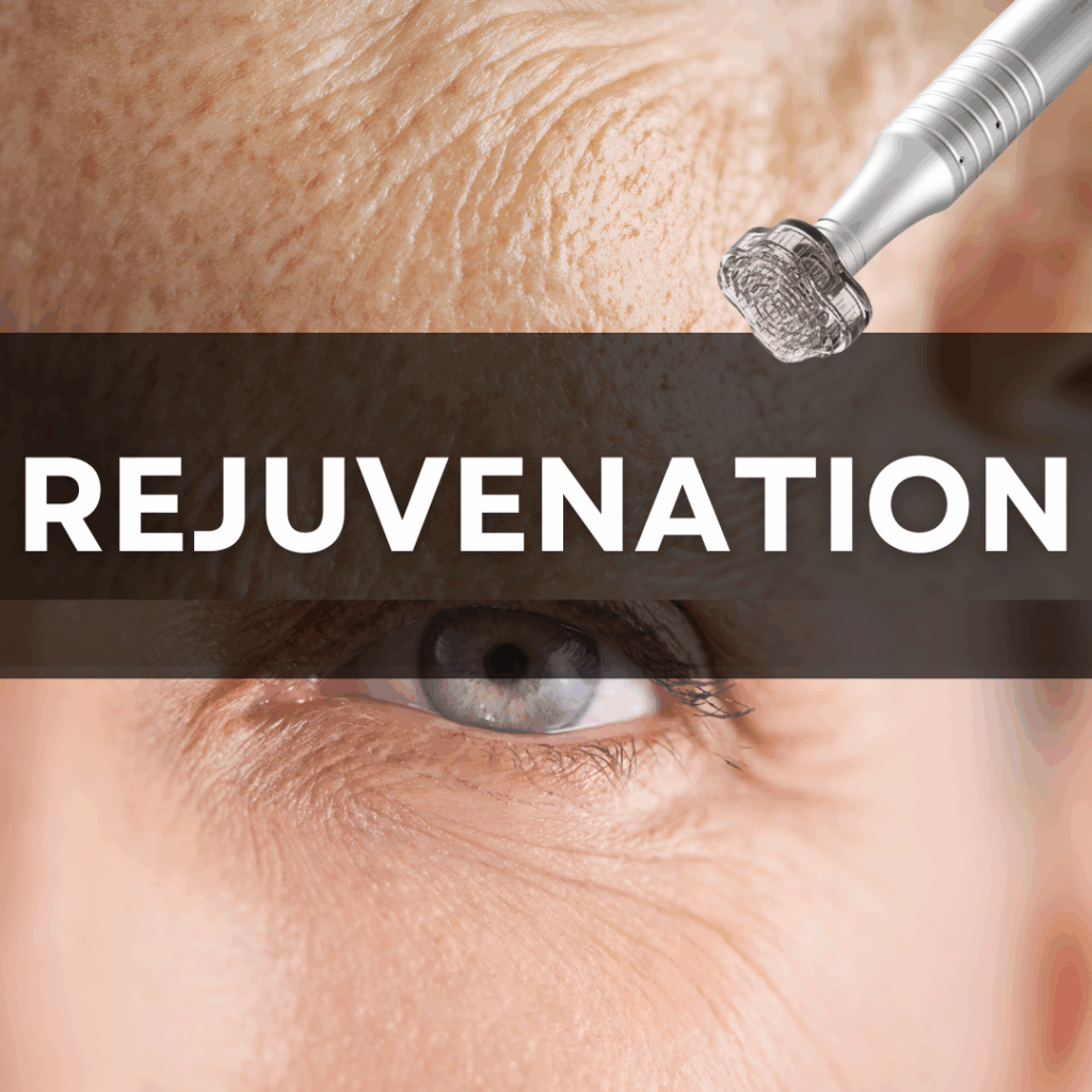 Channel Pro Microchanneling Exosome rejuvenation, finelines, wrinkles treatment protocol